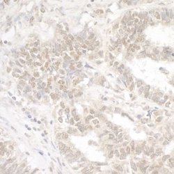 G9a/EHMT2 Antibody, Novus Biologicals 0.1mg; Unlabeled:Antibodies, Polyclonal